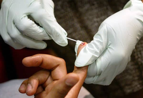 epidemia di HIV nelle Filippine ministero della salute
